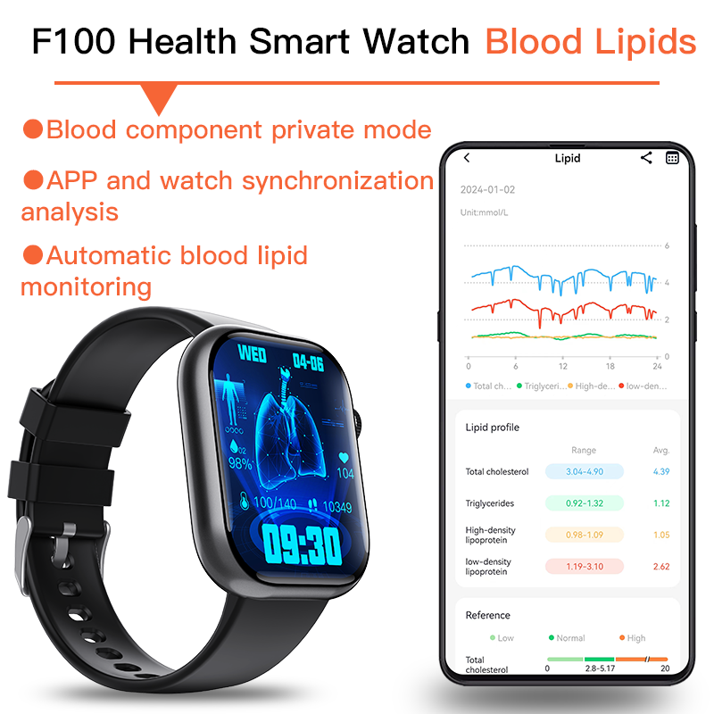 Best ECG Smart Watch of 2025 With Blood Pressure Monitor+Blood Glucose Monitoring-1